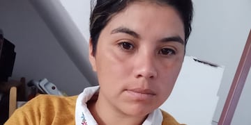 Verónica Portillo, es una de las denunciantes de abuso sexual contra el intendente Ángel Fabián Constantino. Foto: TN.