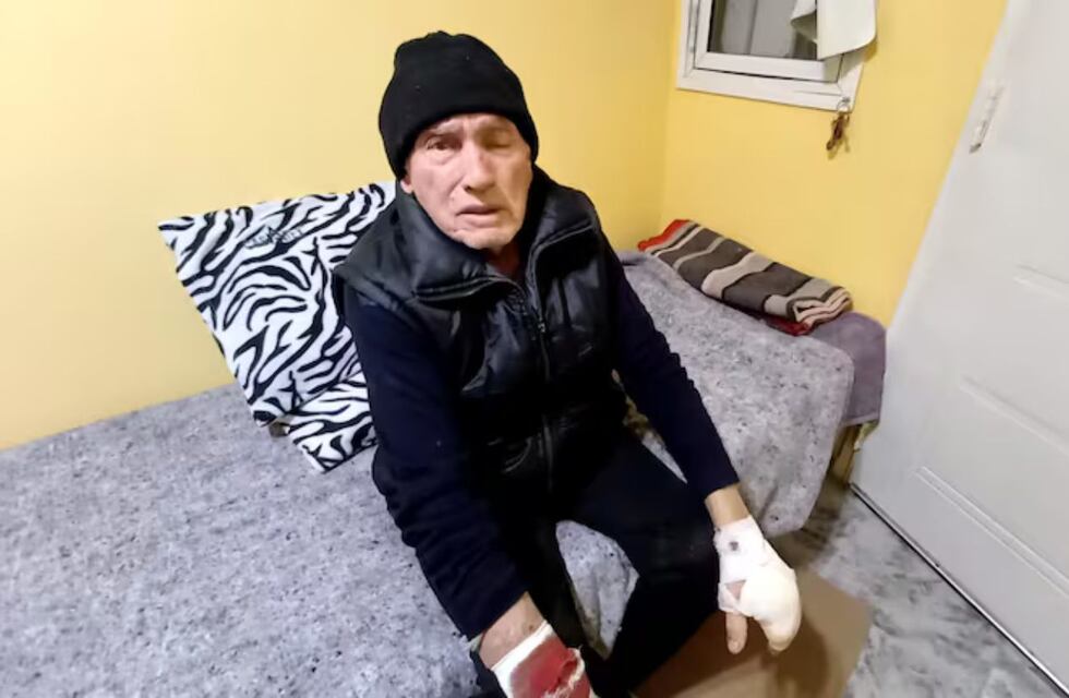 Asaltaron y golpearon brutalmente a un jubilado: buscan intensamente a los delincuentes en Bialet Massé