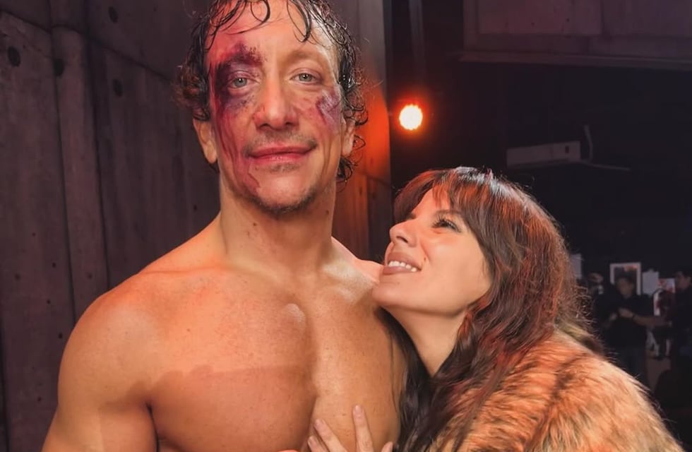 Cuánto cuesta la entrada de “Rocky”, la obra de Nico Vázquez, en medio del escándalo por su separación de Gimena Accardi