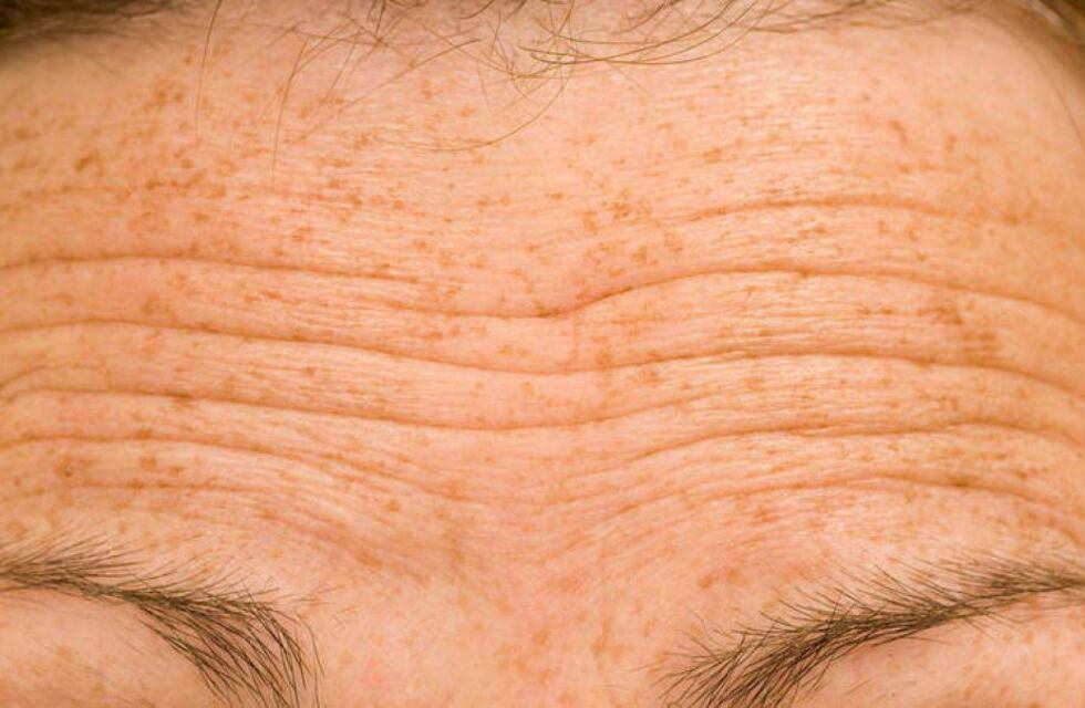 Chau arrugas: las 3 maneras efectivas de quitarlas de tu cuerpo