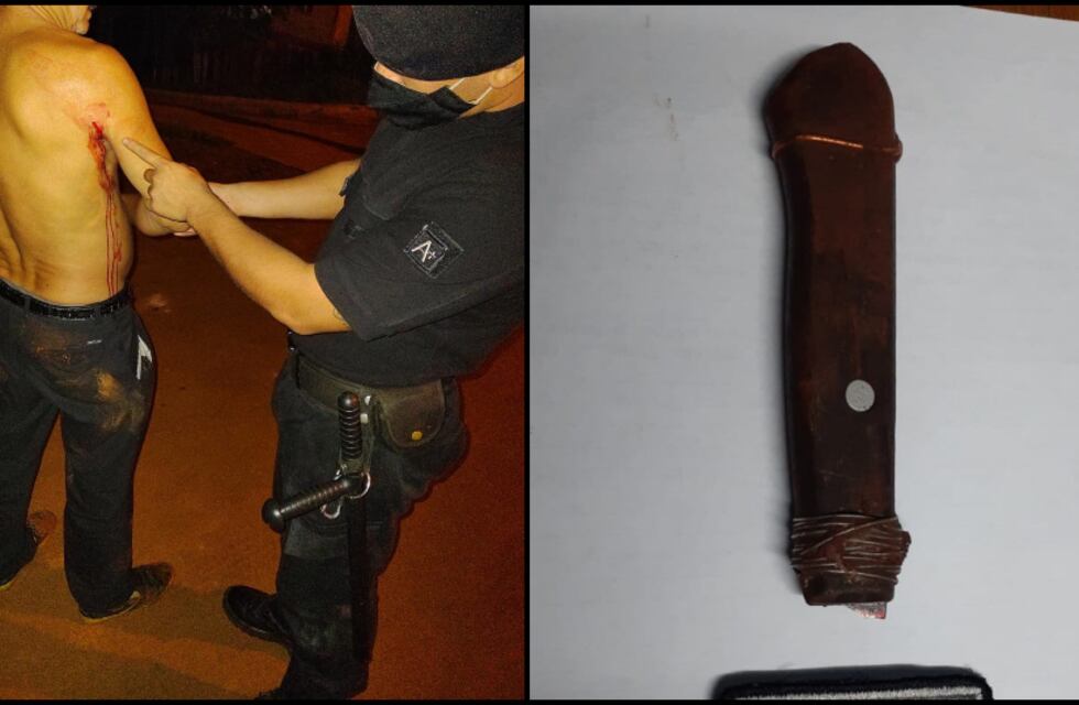 Una mujer apuñaló a su concubino en la axila