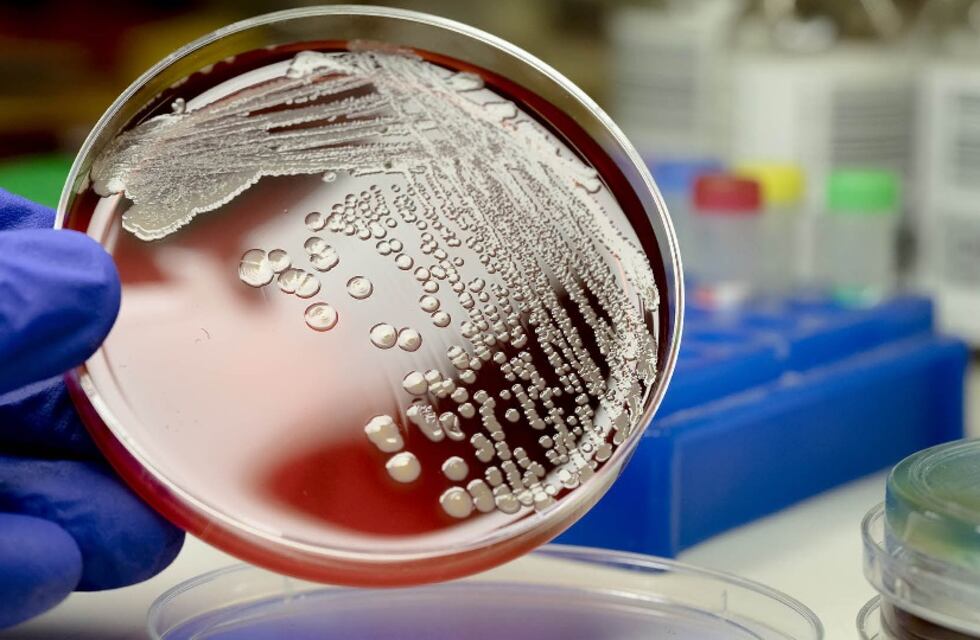 Alerta en San Juan: detectaron casos de una enfermedad viral y de alto riesgo