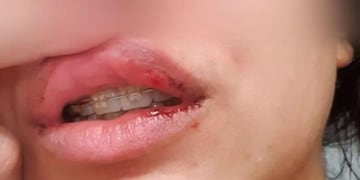 La joven reveló las agresiones que sufría en redes sociales. (Foto: Cuarteteando.com)