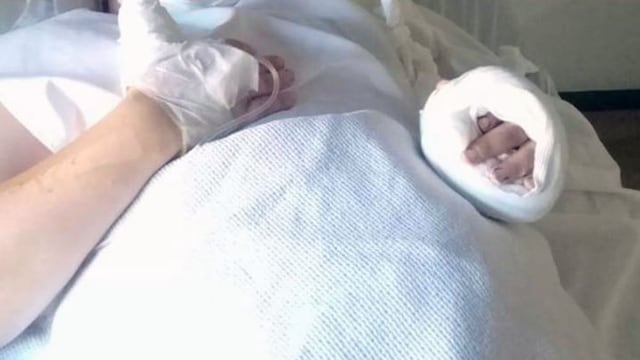 De no evolucionar favorablemente la mujer podría perder la mano