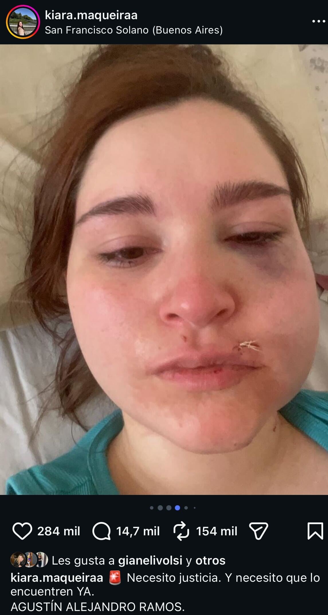 Ataque feroz en Solano.