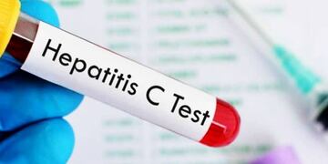 Hepatitis C: Mendoza es parte de la campaña nacional de concientización y detección gratuita.