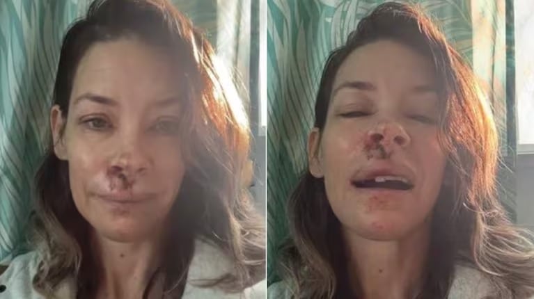 Evangeline Lilly confirmó que tiene daño cerebral después de un accidente que sufrió en Hawaii.