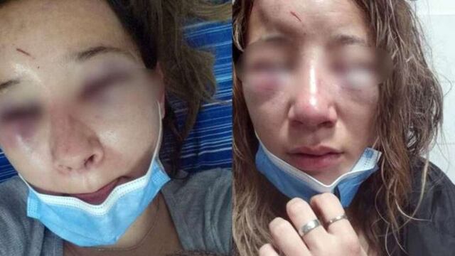 Una joven de 24 fue atacada brutalmente a la salida de un boliche por dos mujeres.