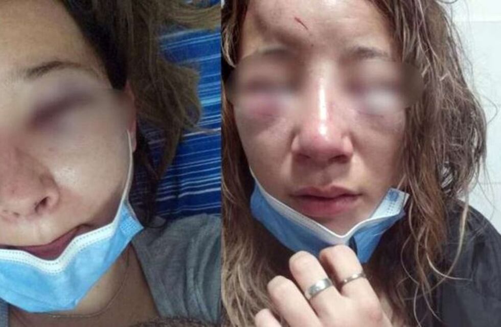 La atacaron a golpes a la salida de un boliche y le arrancaron las uñas