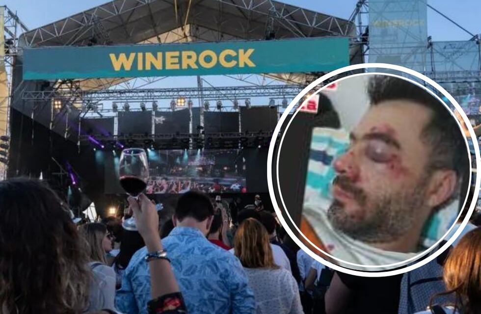 Un joven fue agredido luego de un evento cultural y pide ayuda para dar con los agresores