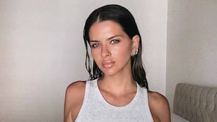 La China Suárez sufrió un accidente en un rodaje y mostró cómo quedó su nariz: “Me rompí”