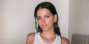 La China Suárez sufrió un accidente en un rodaje y mostró cómo quedó su nariz: “Me rompí”