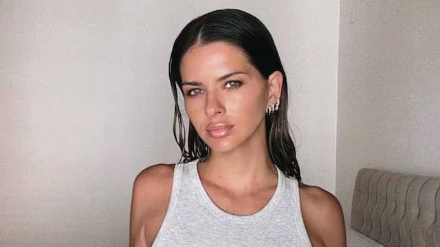 La China Suárez sufrió un accidente en un rodaje y mostró cómo quedó su nariz: “Me rompí”