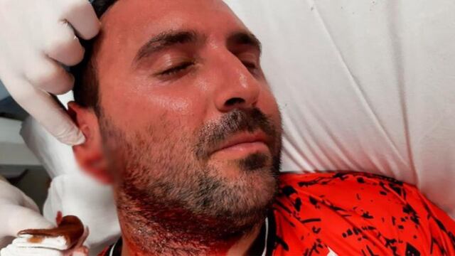 Un defensor le mordió la oreja a un rival.