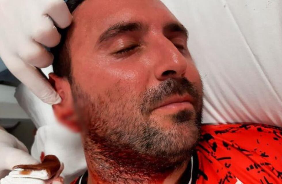 Violencia en Córdoba: en medio de un partido, imitó a Luis Suárez y le mordió la oreja a un rival