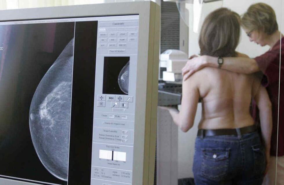 Solicitan un nuevo mamógrafo para el Hospital Municipal Eva Perón