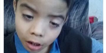El pequeño necesita operarse de los ojos y pide ayuda