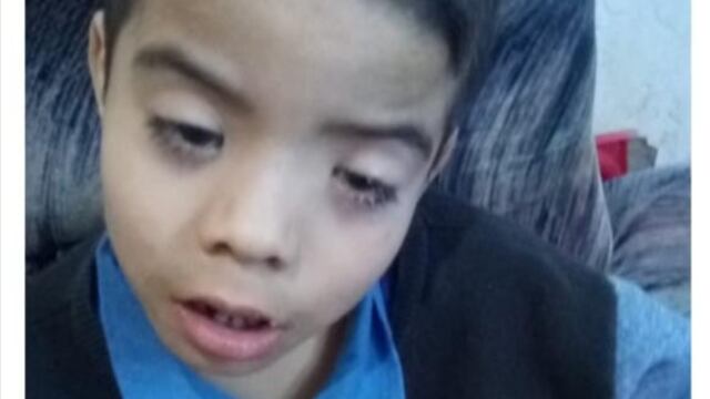 El pequeño necesita operarse de los ojos y pide ayuda