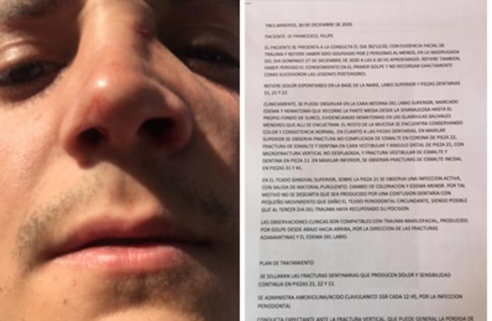 Los abogados del joven agredido por rugbiers en Claromecó dieron a conocer los informes médicos