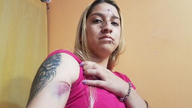 Melisa fue atacada por otras chicas con botellas rotas (foto, El Doce).