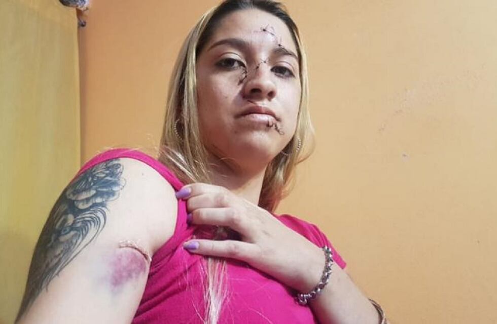 Córdoba violenta: la atacaron con una botella rota, en una fiesta