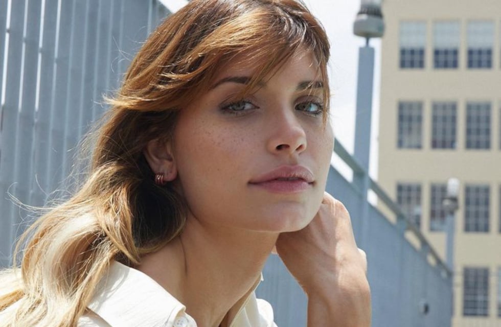 Eva de Dominici mostró las quemaduras en su cuerpo: “No me gustaba hablar del accidente”