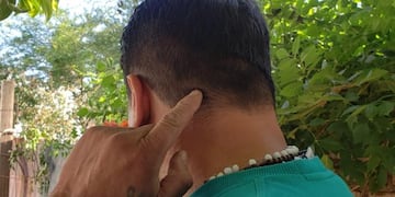 El padre de la pequeña fue el primero en auxiliarla. (El Doce)