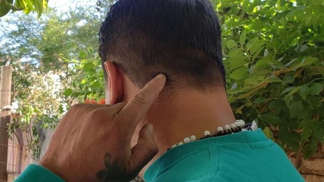 El padre de la pequeña fue el primero en auxiliarla. (Foto: El Doce)