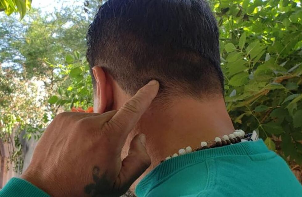 Otra vez Yofre: tiene 9 años, andaba en bicicleta y una bala le pegó en la nuca