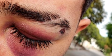 Joven denunció a Bebelo Reynoso por una golpiza. (El Doce)