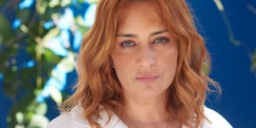 La terrible foto de María Julia Olivan tras quemarse el cuerpo en un accidente doméstico: “Zafé...”