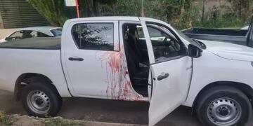 Brutal ataque de un hombre hacia su pareja, en Chacras de Cuyo. La mujer alcanzó a relatar lo sucedido y luego falleció.
