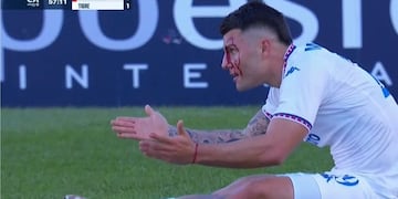 Así de ensangrentando quedó el rostro de Ignacio Russo, por los taponazos en la frente en el San Lorenzo-Tigre (Captura).