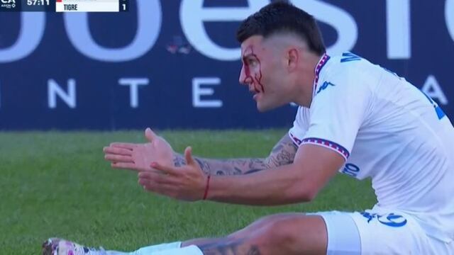 Así de ensangrentando quedó el rostro de Ignacio Russo, por los taponazos en la frente en el San Lorenzo-Tigre (Captura).