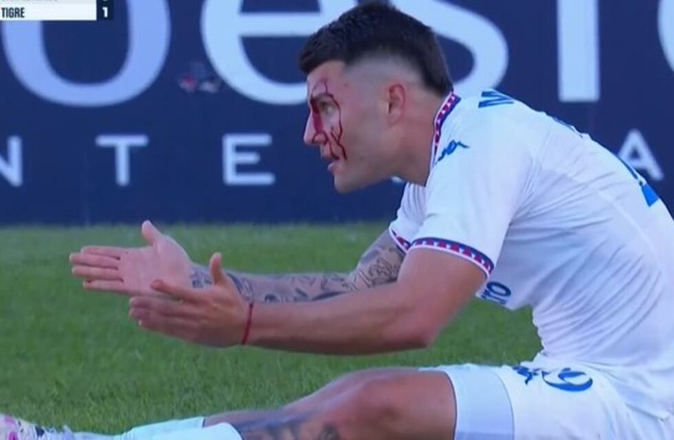 El ex Instituto que recibió una terrible patada en la cara en el San Lorenzo-Tigre