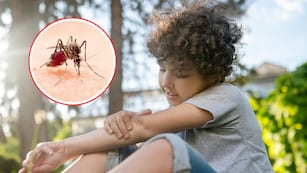 Dengue en niños: cuáles son los síntomas y qué hacer si mi hijo tiene.
