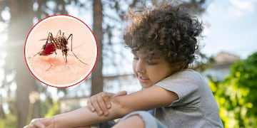 Dengue en niños: cuáles son los síntomas y qué hacer si mi hijo tiene.
