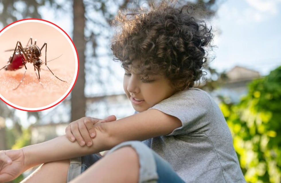 Dengue en niños: cuáles son los síntomas y qué hacer si mi hijo tiene