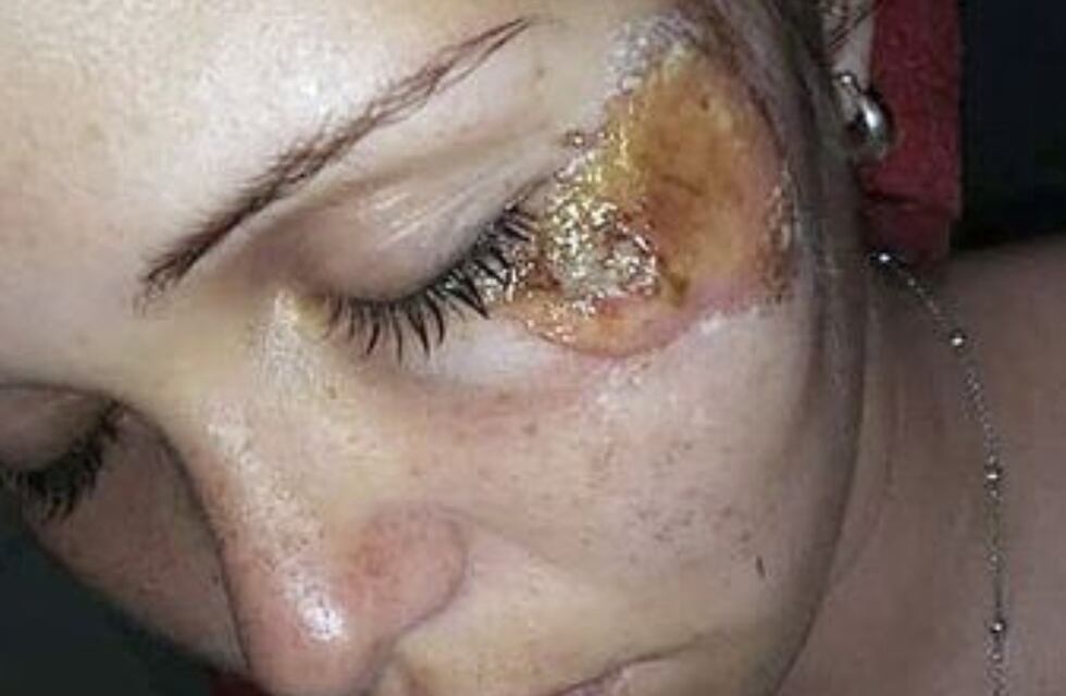 Violencia de género en Córdoba: irá a juicio tras ser acusado de arrastrar a su ex con el auto