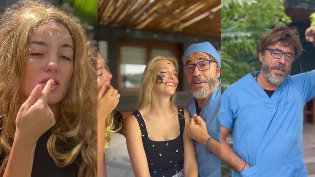 La esposa de Michael Bublé terminó con la cara deformada en el sketch.