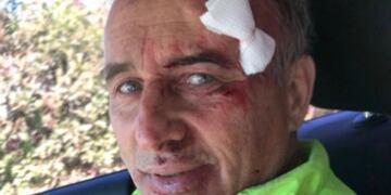 El ex árbitro se accidentó en su bicicleta.