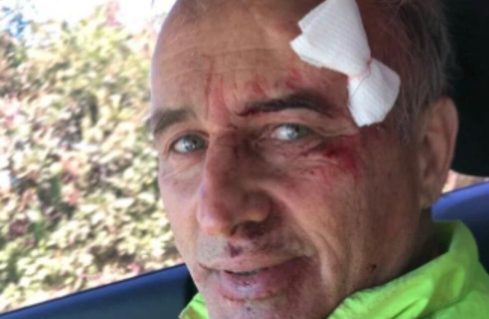 ¿Qué le pasó a Baldassi?: la preocupación de sus seguidores por la última foto publicada