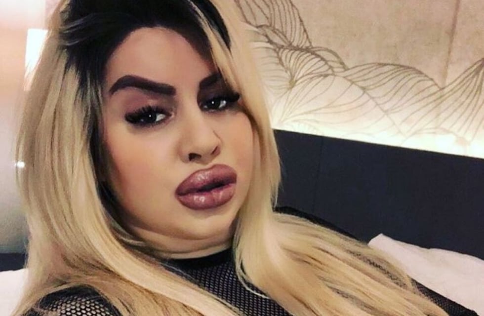 Quién es Natasha Crown, la modelo sueca que gastó más de 150.000 dólares para tener la “cola más grande del mundo”