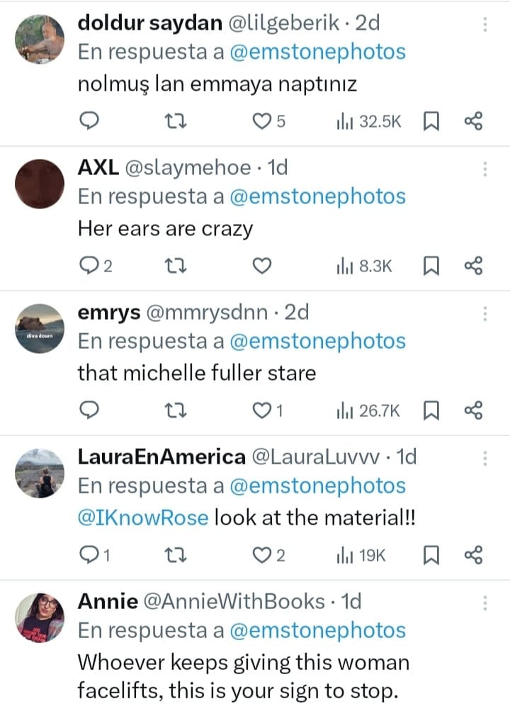 Critican a Emma Stone por su apariencia.