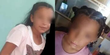 Yazmín Fernández tiene 11 años y quedó en grave estado tras caer de un cerro.