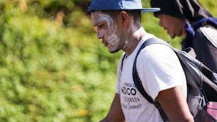 Un migrante con protector solar en el rostro camina sobre la carretera en Escuintla, en el sur de México, en su odisea hacia la frontera norte del país y con destino a Estados Unidos, el jueves 7 de noviembre de 2024. (AP Foto/Moisés Castillo)