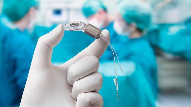 El Servicio de Otorrinolaringología del Hospital Luis Lagomaggiore realizó el primer implante coclear en adultos.