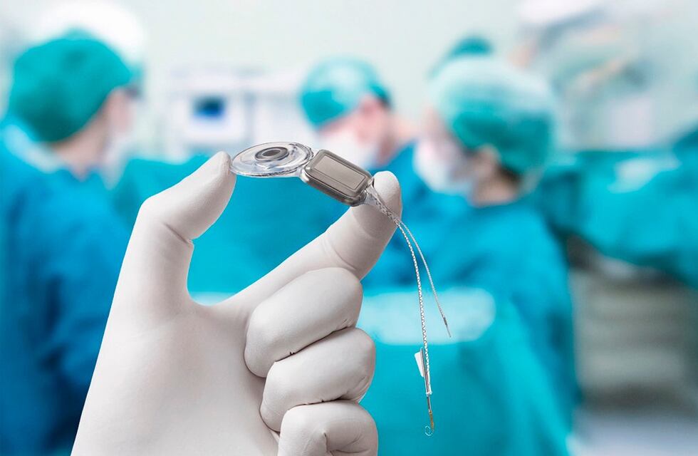 Realizaron el primer implante coclear en el hospital Lagomaggiore