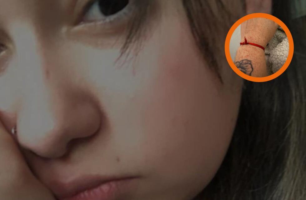 Una puntaltense padece una enfermedad hematológica grave y solicita ayuda