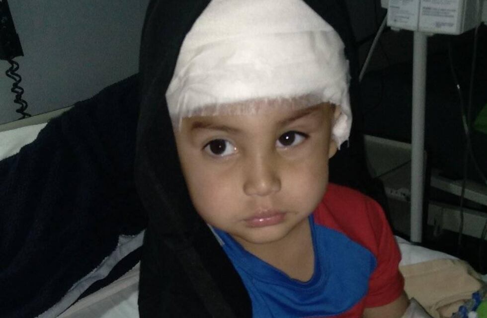 Cómo fueron los minutos de “terror” que atravesó el niño atacado por un perro en San Juan